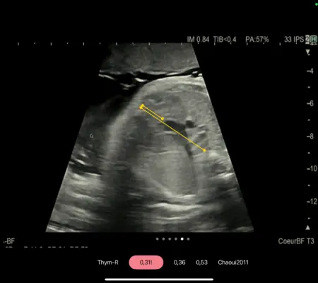 Image of cardiac measurement