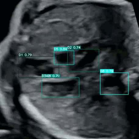 Image of cardiac measurement